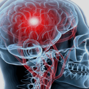 brain health doctor austin, tx