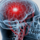 brain health doctor austin, tx